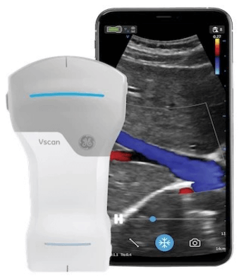 Introducing Portable Ultrasound at Glenelg Orthopaedics